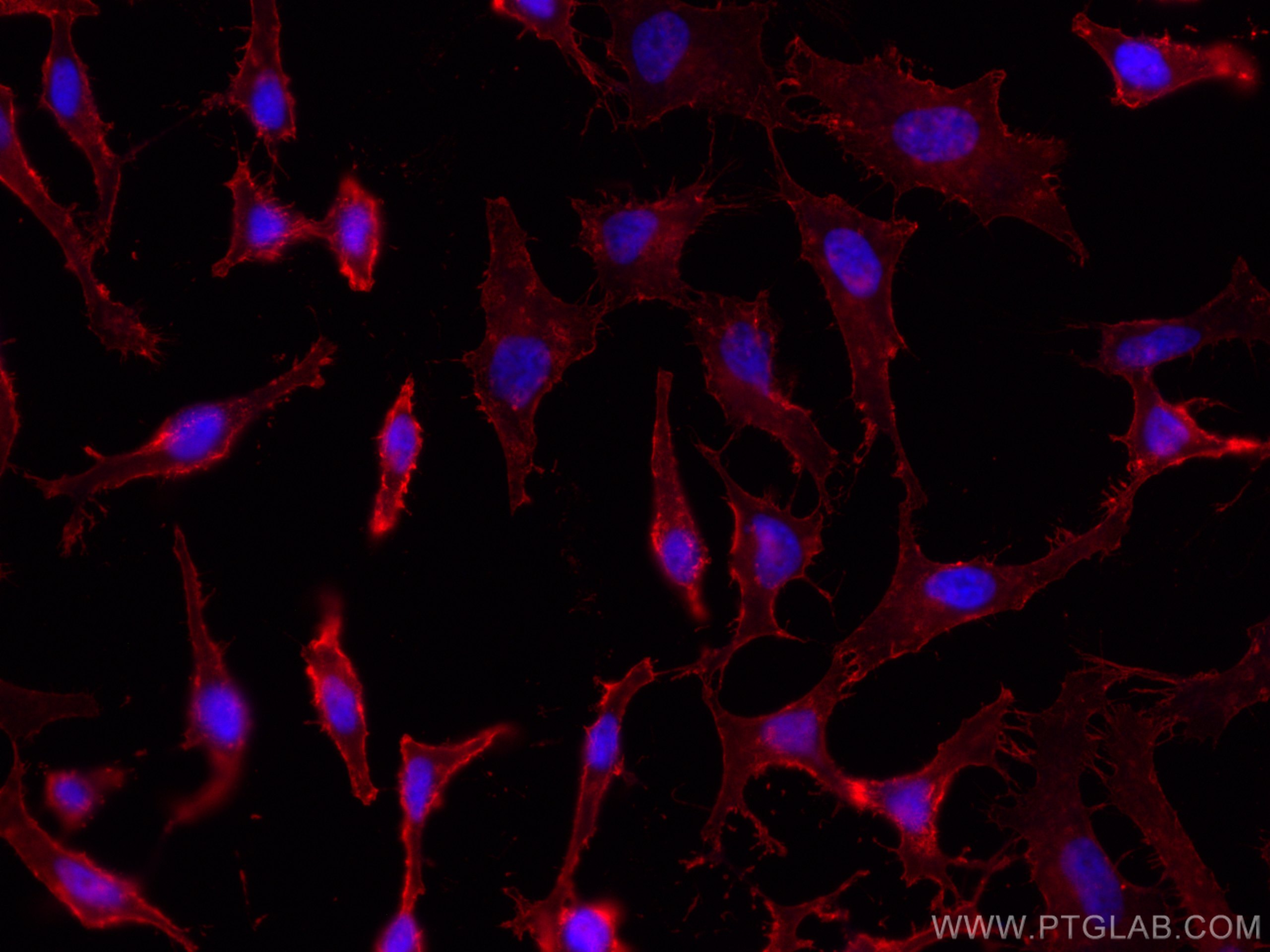 Immunofluorescence (IF) / fluorescent staining of HeLa cells using CoraLite®594-conjugated CD98/SLC3A2 Monoclonal ant (CL594-66883)