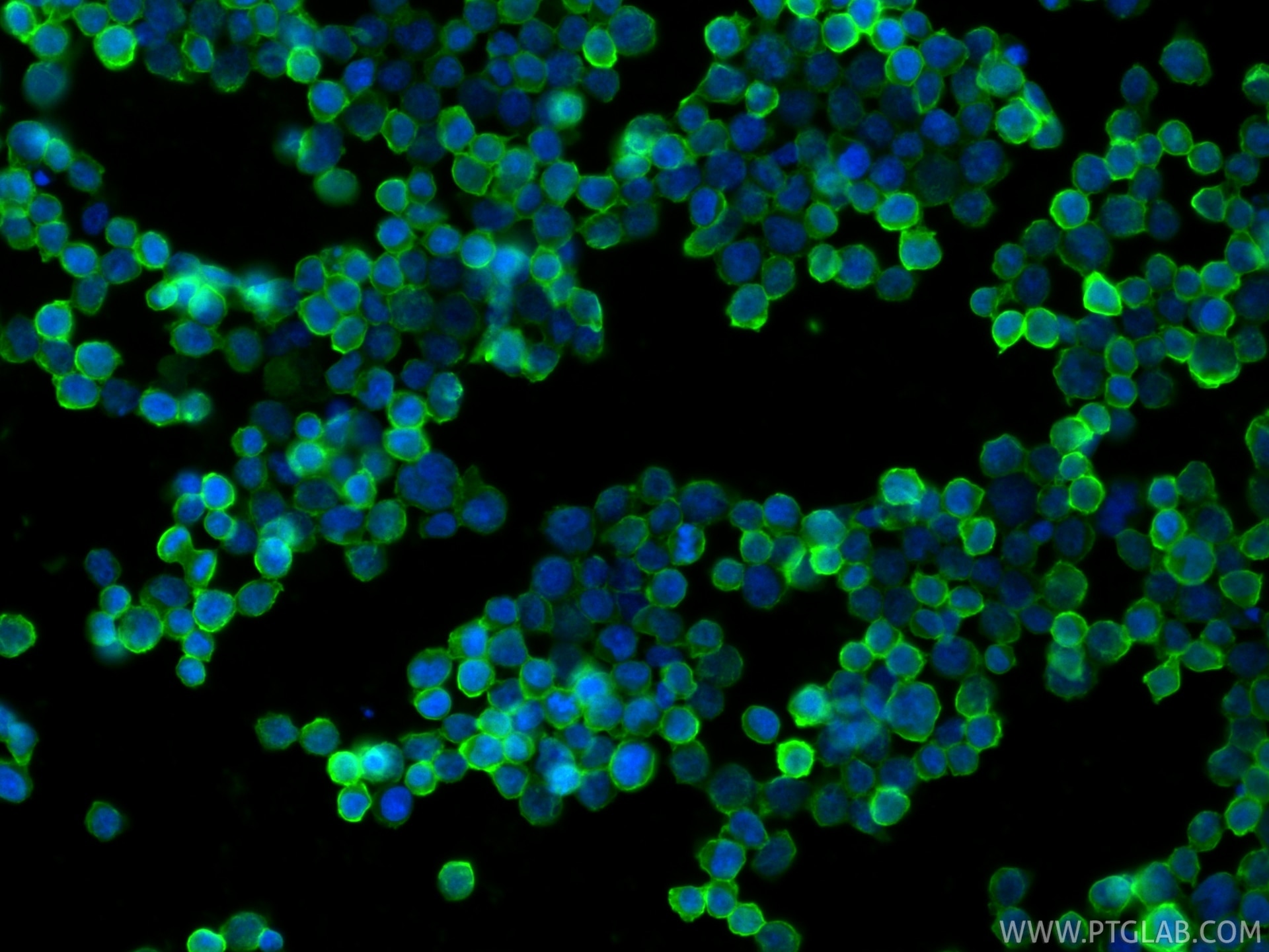 Immunofluorescence (IF) / fluorescent staining of Jurkat cells using CD99 Polyclonal antibody (23079-1-AP)