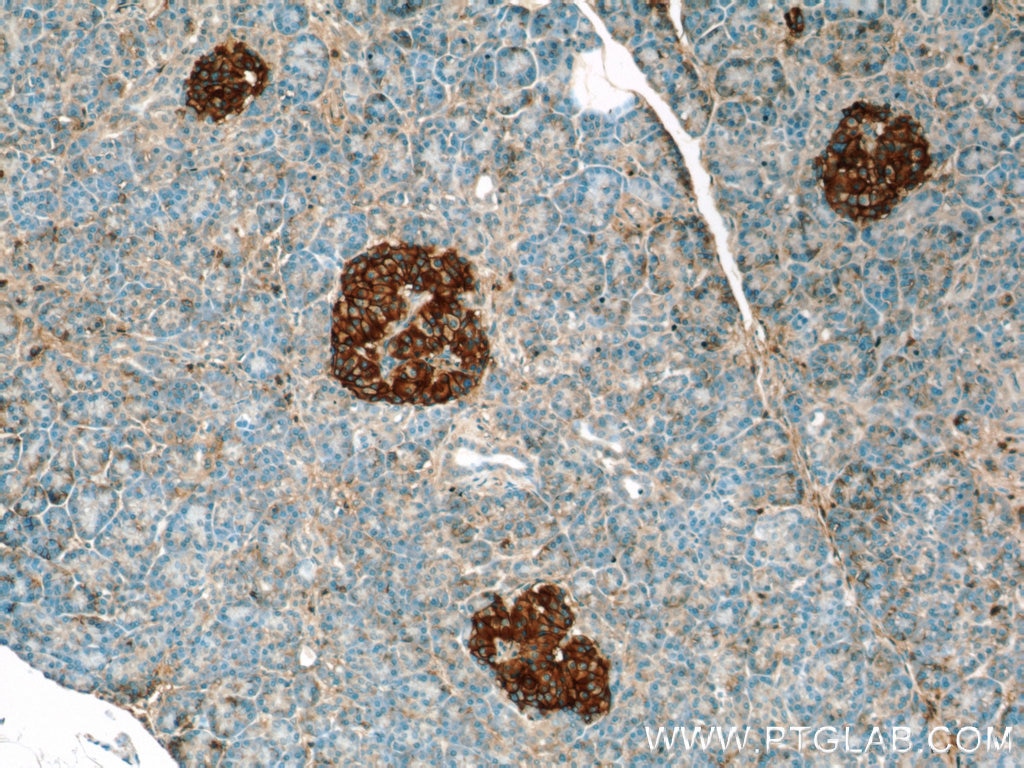 Immunohistochemistry (IHC) staining of human pancreas tissue using CD99 Polyclonal antibody (23079-1-AP)