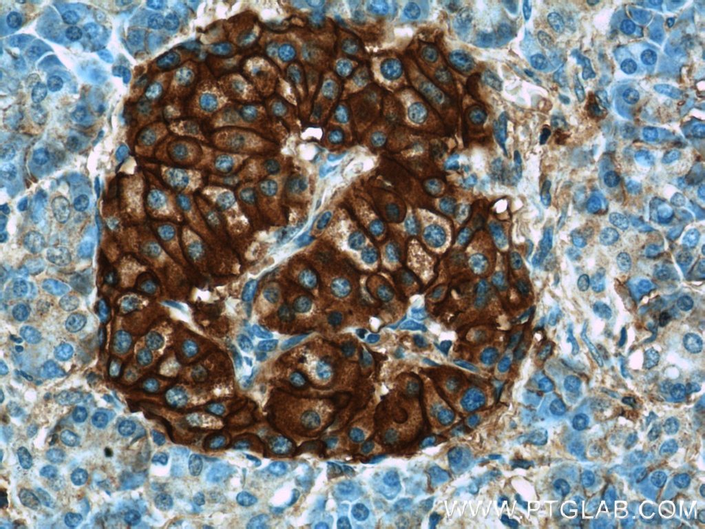 Immunohistochemistry (IHC) staining of human pancreas tissue using CD99 Polyclonal antibody (23079-1-AP)