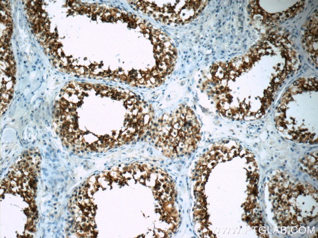 Immunohistochemistry (IHC) staining of human testis tissue using CD99 Polyclonal antibody (23079-1-AP)
