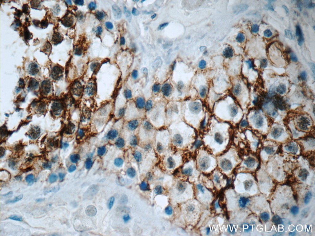 Immunohistochemistry (IHC) staining of human testis tissue using CD99 Polyclonal antibody (23079-1-AP)