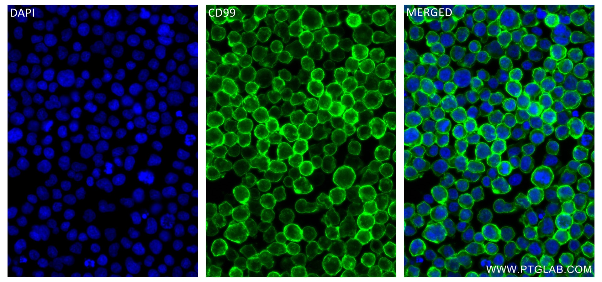 Immunofluorescence (IF) / fluorescent staining of Jurkat cells using CD99 Recombinant antibody (84580-4-RR)