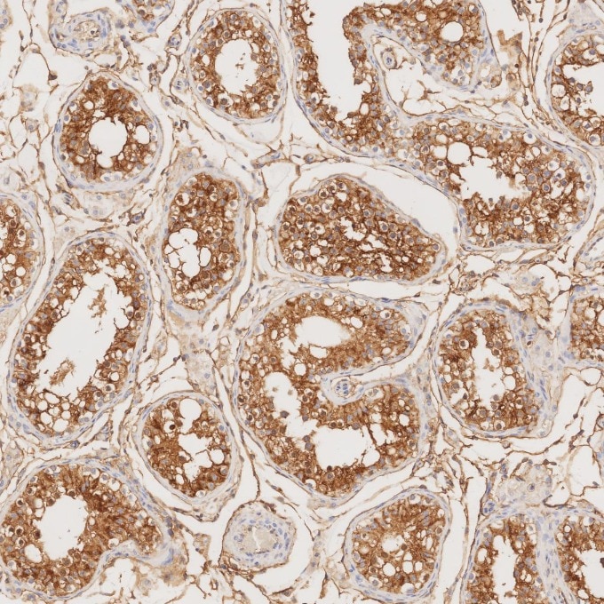 Immunohistochemistry (IHC) staining of human testis tissue using CD99 Recombinant monoclonal antibody (84580-4-RR)