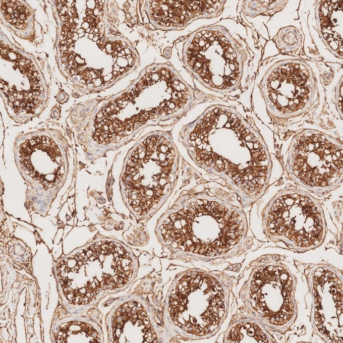 Immunohistochemistry (IHC) staining of human testis tissue using CD99 Recombinant monoclonal antibody (84580-4-RR)