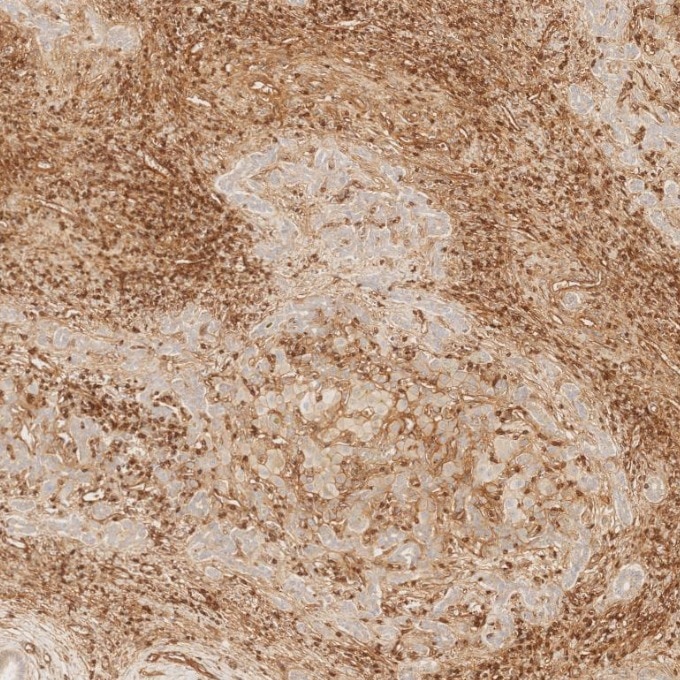 Immunohistochemistry (IHC) staining of human liver tissue using CD99 Recombinant monoclonal antibody (84580-4-RR)
