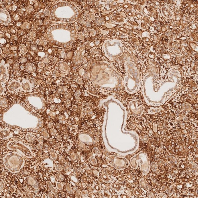Immunohistochemistry (IHC) staining of human kidney tissue using CD99 Recombinant monoclonal antibody (84580-4-RR)