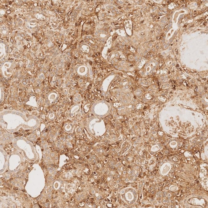 Immunohistochemistry (IHC) staining of human kidney tissue using CD99 Recombinant monoclonal antibody (84580-4-RR)