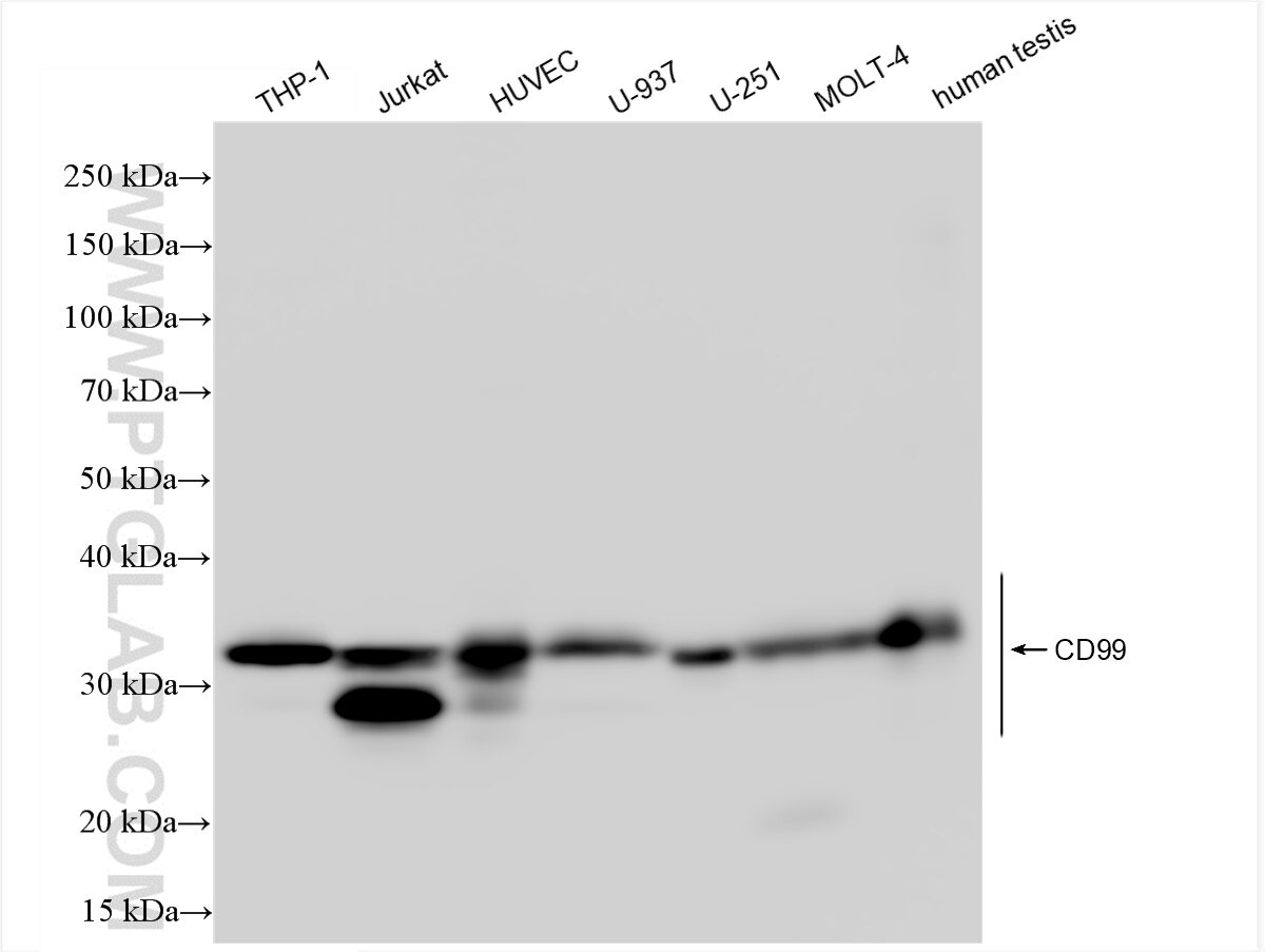 Western Blot (WB) analysis of various lysates using CD99 Recombinant antibody (84580-4-RR)