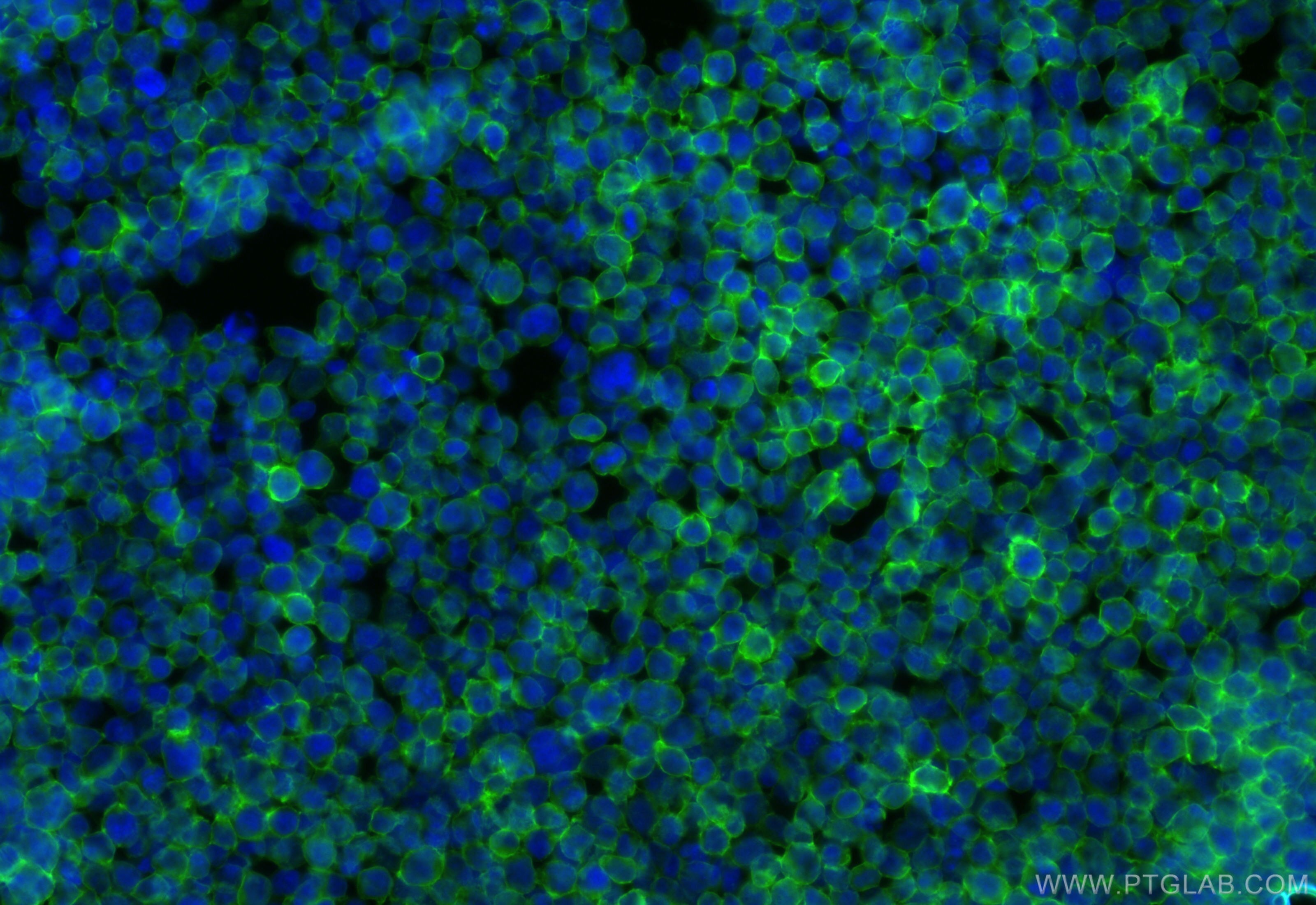 Immunofluorescence (IF) / fluorescent staining of Jurkat cells using CoraLite® Plus 488-conjugated CD99 Recombinant ant (CL488-84580-4)