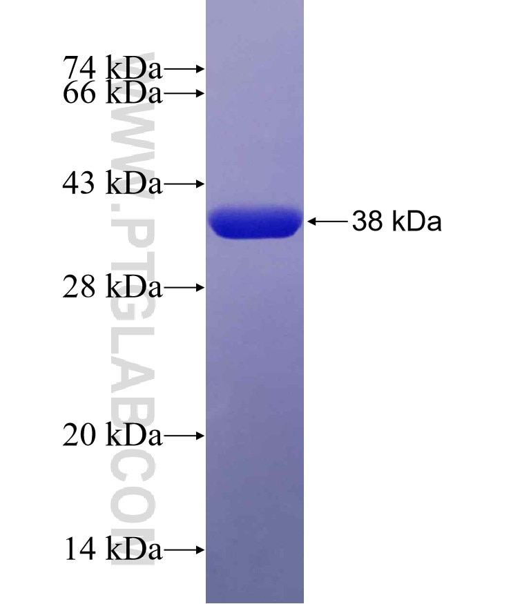 CD99 fusion protein Ag19461 SDS-PAGE