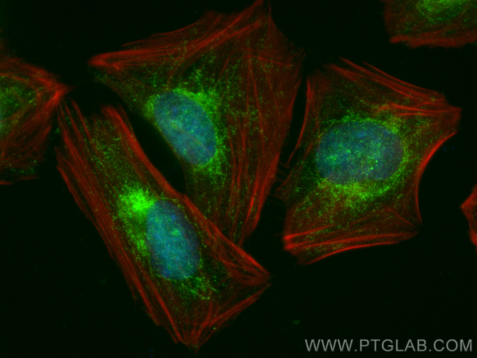 Immunofluorescence (IF) / fluorescent staining of Saos-2 cells using CDADC1 Polyclonal antibody (28169-1-AP)