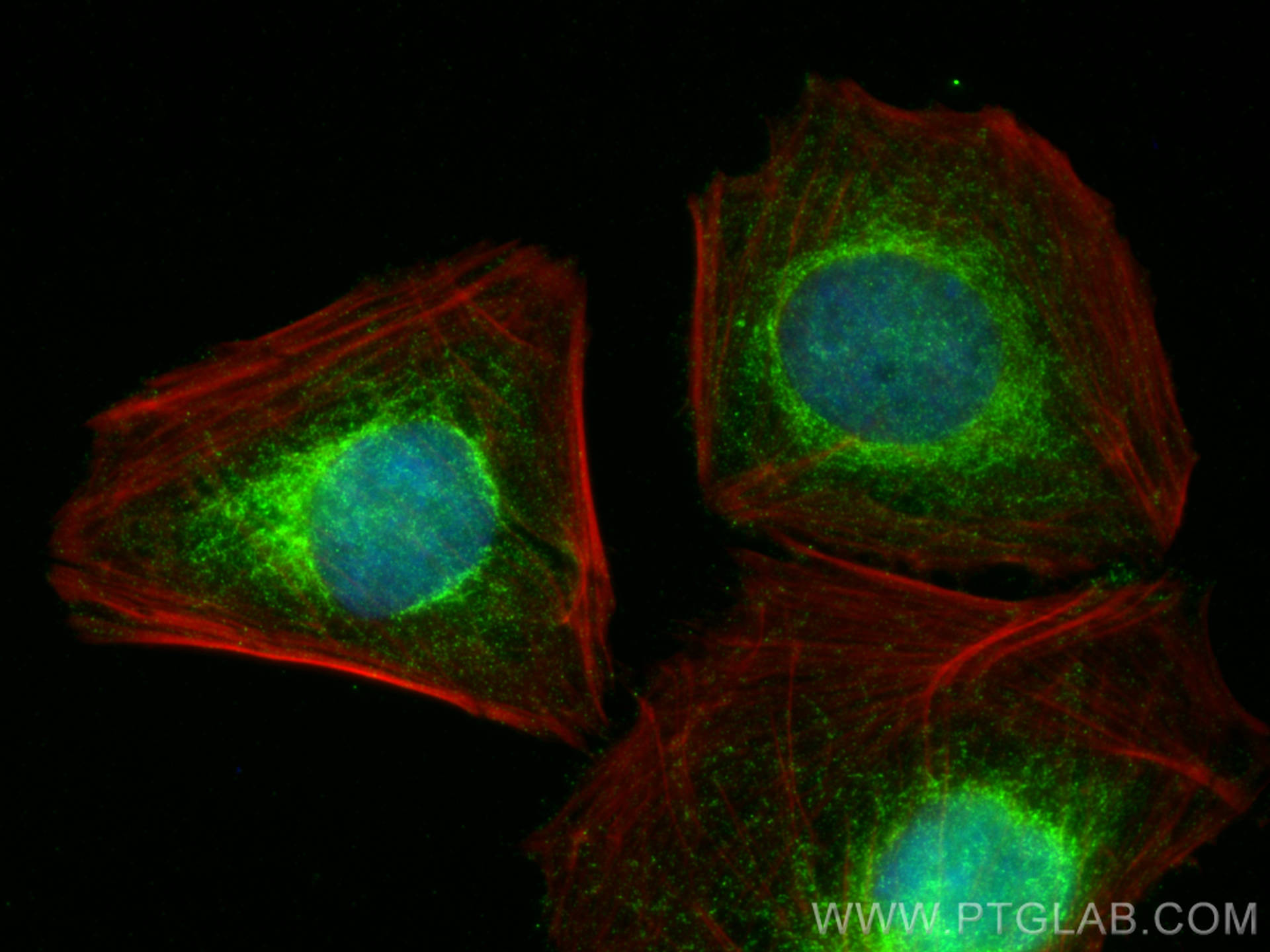 Immunofluorescence (IF) / fluorescent staining of Saos-2 cells using CDADC1 Polyclonal antibody (28169-1-AP)
