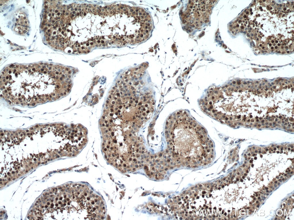 Immunohistochemical analysis of paraffin-embedded human testis tissue slide using 28169-1-AP (CDADC1 antibody) at dilution of 1:200 (under 10x lens. Heat mediated antigen retrieval with Tris-EDTA buffer (pH 9.0). Immunohistochemistry (IHC) staining of human testis tissue using CDADC1 Polyclonal antibody (28169-1-AP)
