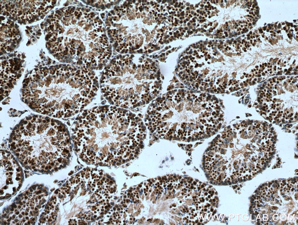 Immunohistochemical analysis of paraffin-embedded mouse testis tissue slide using 28169-1-AP (CDADC1 antibody) at dilution of 1:200 (under 10x lens). Heat mediated antigen retrieval with Tris-EDTA buffer (pH 9.0). Immunohistochemistry (IHC) staining of mouse testis tissue using CDADC1 Polyclonal antibody (28169-1-AP)