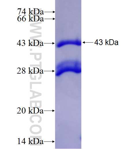 CDADC1 fusion protein Ag27374 SDS-PAGE
