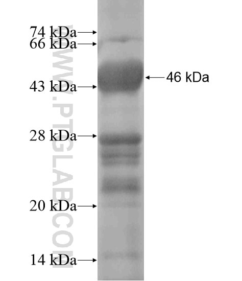 CDADC1 fusion protein Ag18999 SDS-PAGE