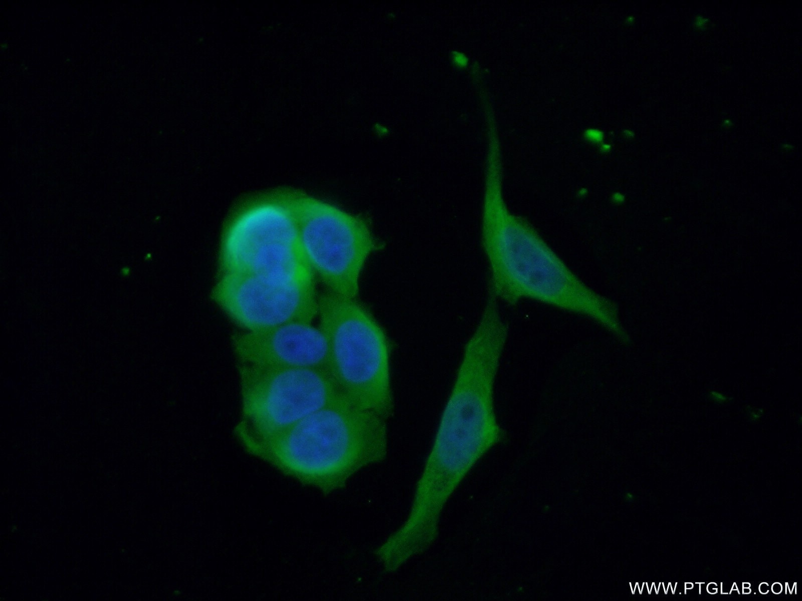 Immunofluorescence (IF) / fluorescent staining of HeLa cells using CDAN1 Polyclonal antibody (17597-1-AP)