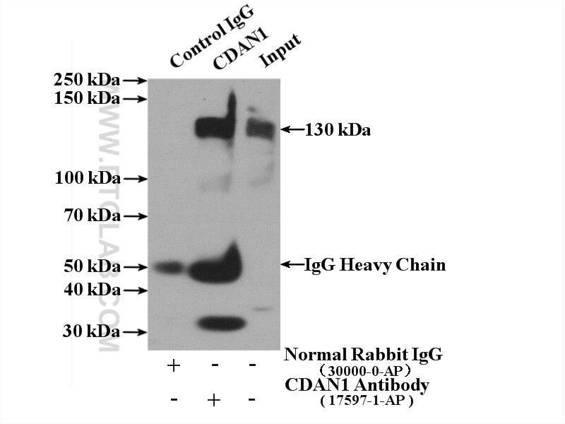 Immunoprecipitation (IP) experiment of K-562 cells using CDAN1 Polyclonal antibody (17597-1-AP)