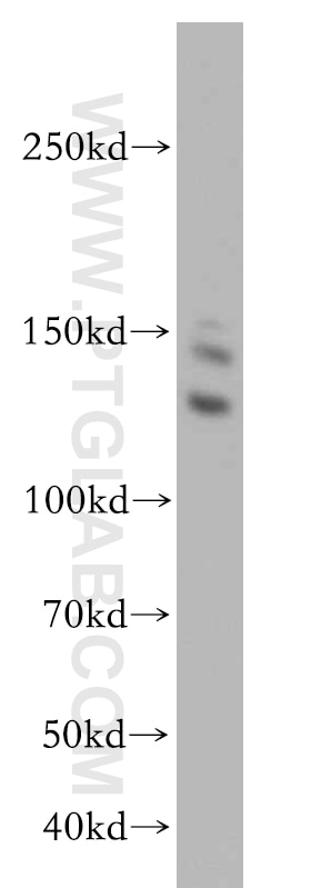 Western Blot (WB) analysis of HeLa cells using CDAN1 Polyclonal antibody (17597-1-AP)
