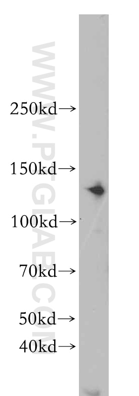 Western Blot (WB) analysis of K-562 cells using CDAN1 Polyclonal antibody (17597-1-AP)