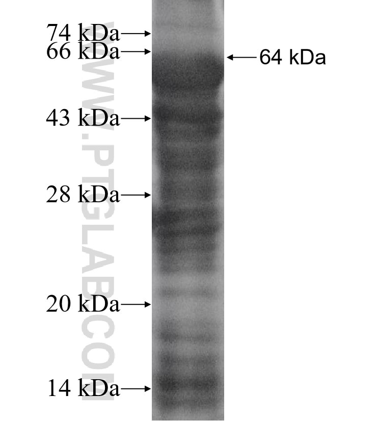CDAN1 fusion protein Ag11589 SDS-PAGE