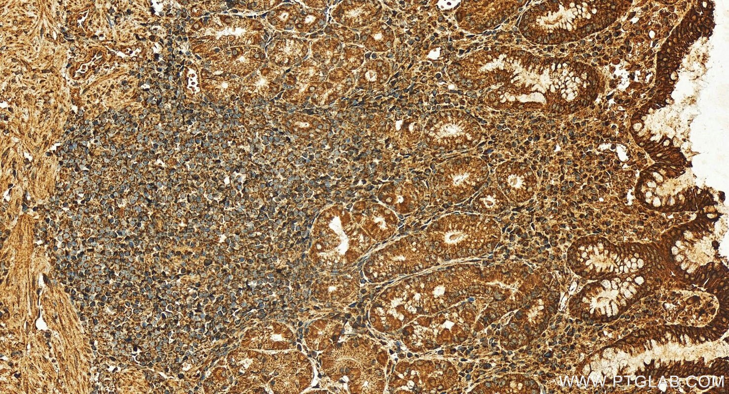 Immunohistochemistry (IHC) staining of human stomach tissue using CDC123/C10orf7 Polyclonal antibody (28178-1-AP)