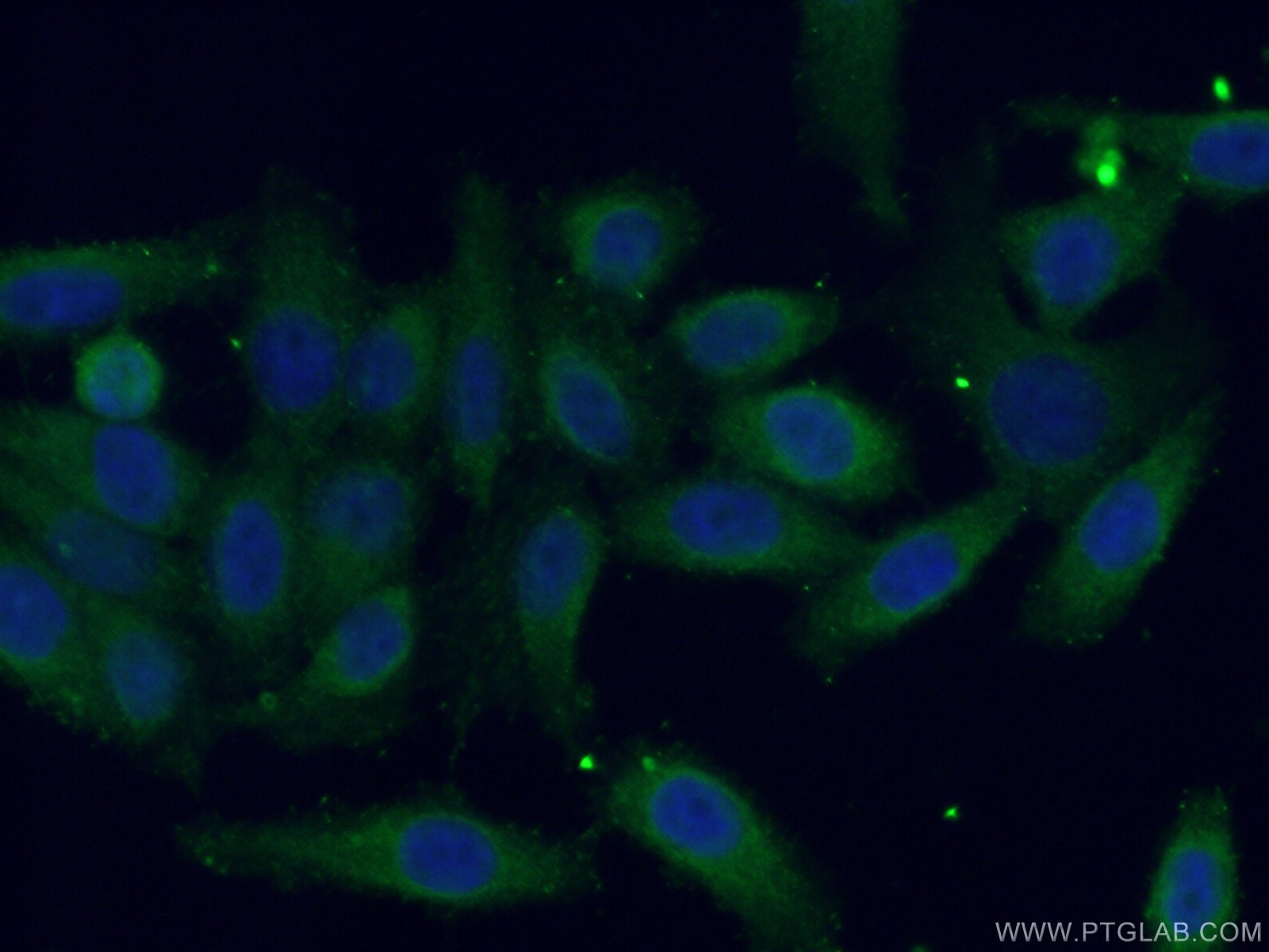 Immunofluorescence (IF) / fluorescent staining of HeLa cells using CDC123/C10orf7 Polyclonal antibody (28178-1-AP)