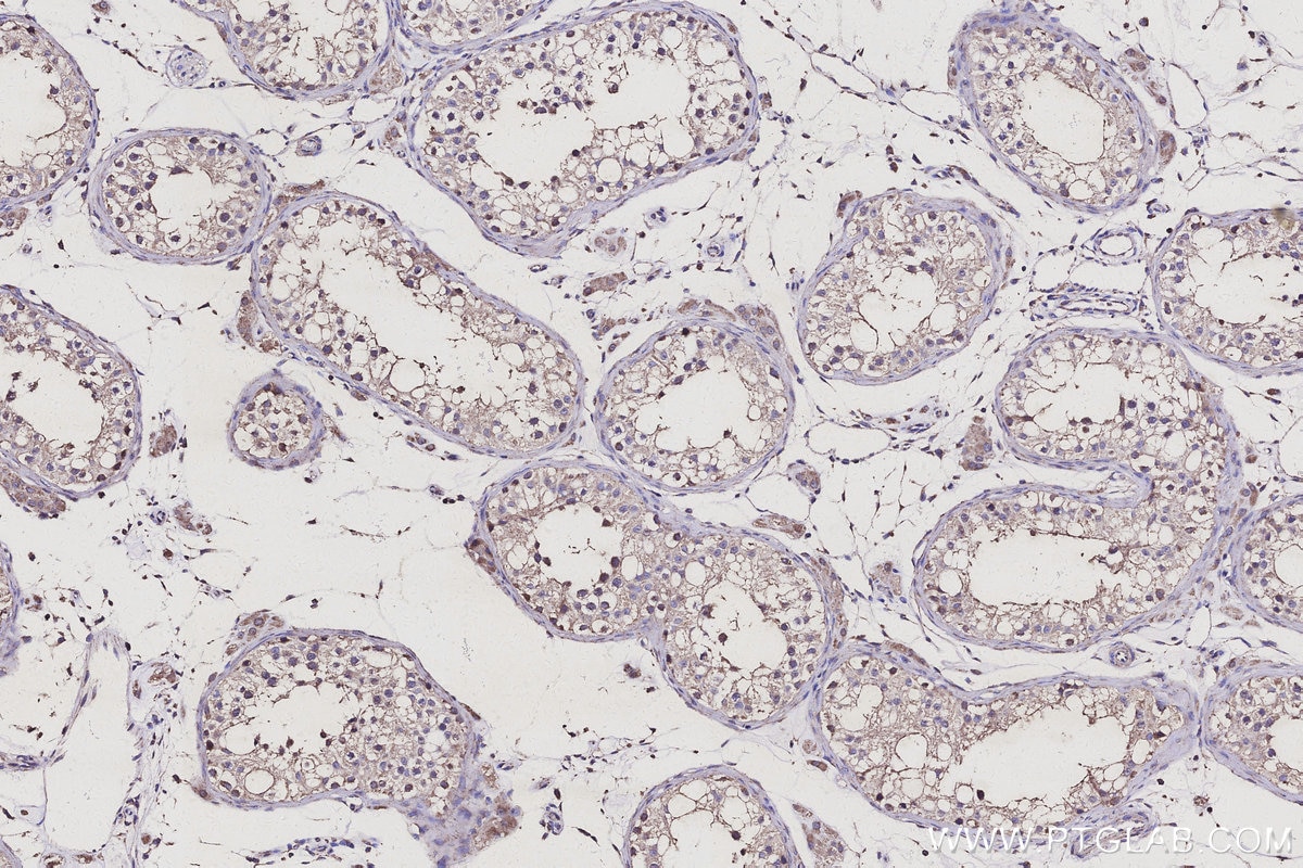 IHC staining of human testis using 28178-1-AP Immunohistochemistry (IHC) staining of human testis tissue using CDC123/C10orf7 Polyclonal antibody (28178-1-AP)