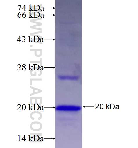 CDC123 fusion protein Ag26828 SDS-PAGE