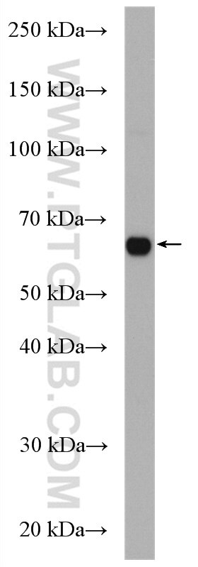 Western Blot (WB) analysis of COLO 320 cells using CDC14A Polyclonal antibody (13660-1-AP)