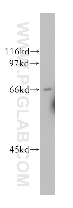 Western Blot (WB) analysis of human brain tissue using CDC14A Polyclonal antibody (13660-1-AP)