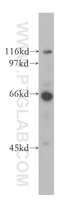 Western Blot (WB) analysis of HeLa cells using CDC14A Polyclonal antibody (13660-1-AP)