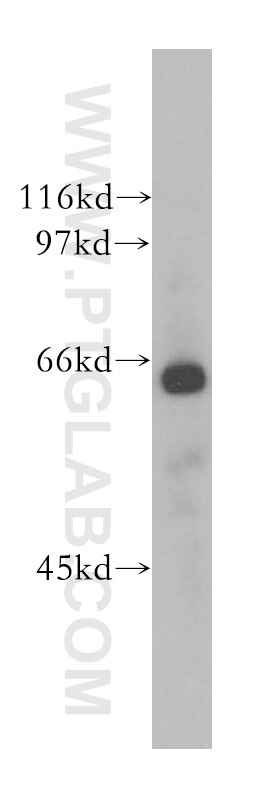 Western Blot (WB) analysis of human heart tissue using CDC14A Polyclonal antibody (13660-1-AP)