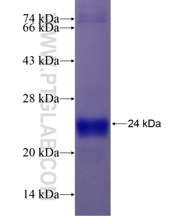 CDC14A fusion protein Ag4969 SDS-PAGE