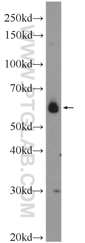 Western Blot (WB) analysis of SMMC-7721 cells using CDC14B Polyclonal antibody (25187-1-AP)