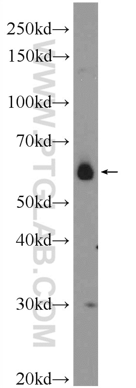 WB analysis of SMMC-7721 using 25187-1-AP