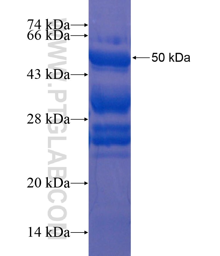 CDC14B fusion protein Ag18227 SDS-PAGE
