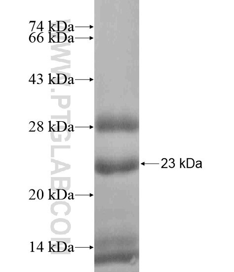 CDC14B fusion protein Ag18995 SDS-PAGE
