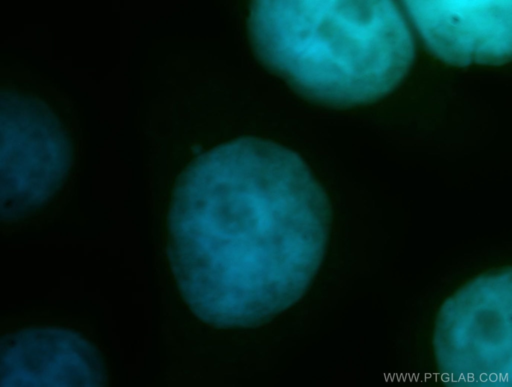 Immunofluorescence (IF) / fluorescent staining of HeLa cells using CDC16/APC6 Polyclonal antibody (14307-1-AP)