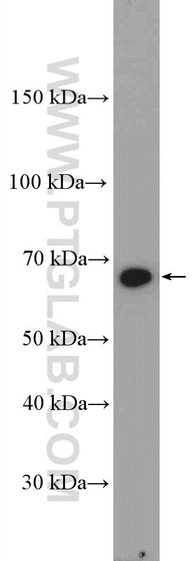 Western Blot (WB) analysis of NIH/3T3 cells using CDC16/APC6 Polyclonal antibody (14307-1-AP)