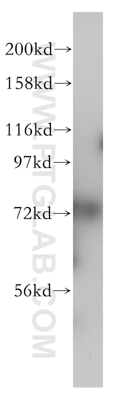 Western Blot (WB) analysis of HeLa cells using CDC16/APC6 Polyclonal antibody (14307-1-AP)