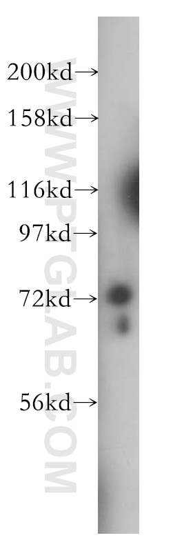 Western Blot (WB) analysis of K-562 cells using CDC16/APC6 Polyclonal antibody (14307-1-AP)