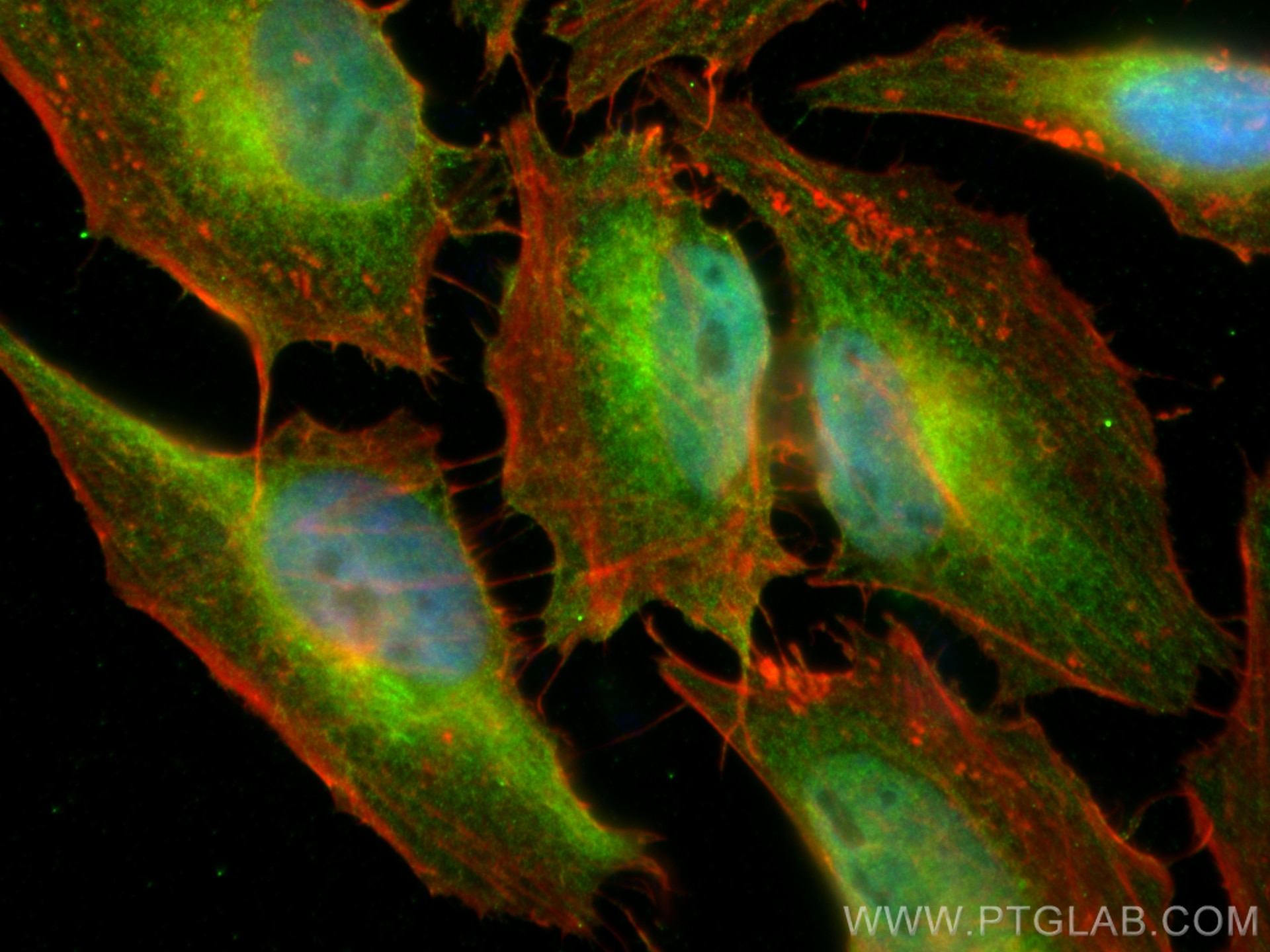 Immunofluorescence (IF) / fluorescent staining of HeLa cells using CDK1-Specific Polyclonal antibody (19532-1-AP)