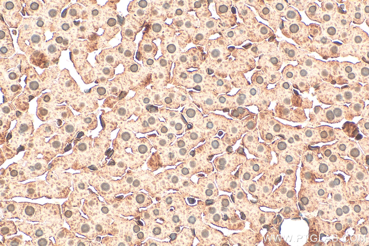 Immunohistochemistry (IHC) staining of rat liver tissue using CDK1-Specific Polyclonal antibody (19532-1-AP)