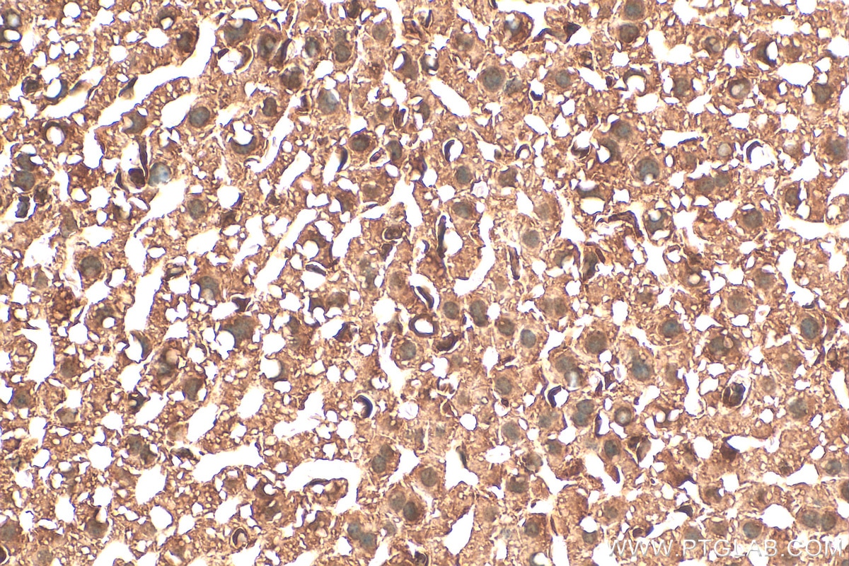Immunohistochemistry (IHC) staining of mouse liver tissue using CDK1-Specific Polyclonal antibody (19532-1-AP)