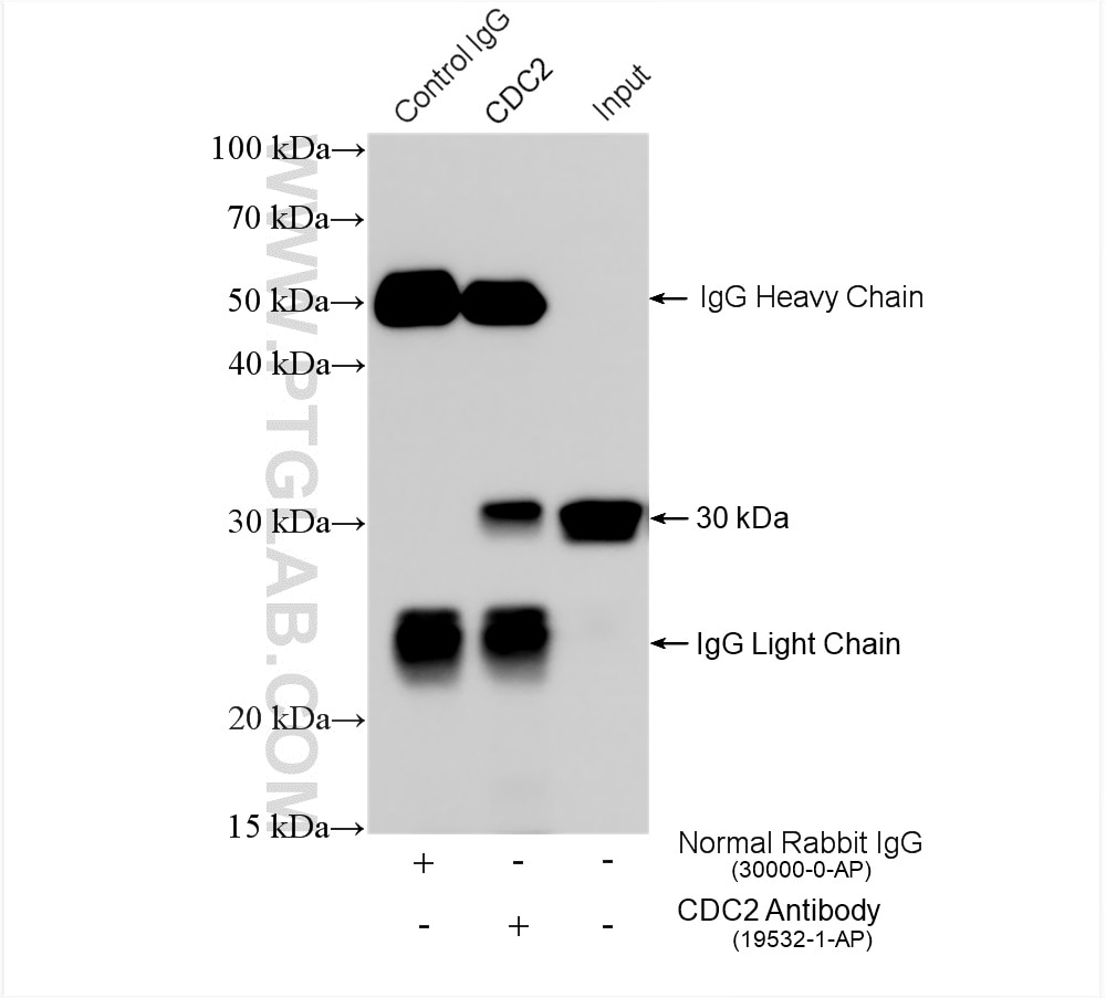 Immunoprecipitation (IP) experiment of HEK-293 cells using CDK1-Specific Polyclonal antibody (19532-1-AP)