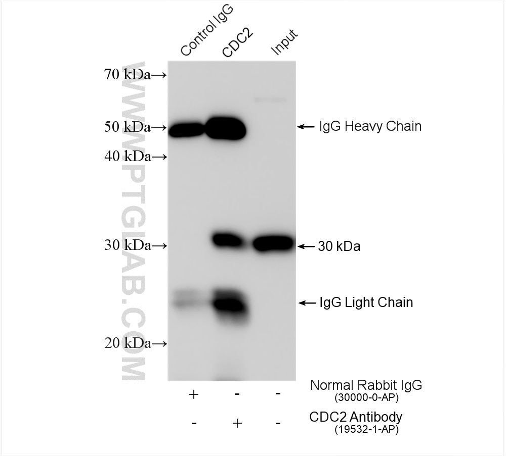 Immunoprecipitation (IP) experiment of HeLa cells using CDK1-Specific Polyclonal antibody (19532-1-AP)