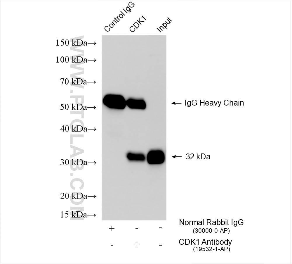 Immunoprecipitation (IP) experiment of HeLa cells using CDK1-Specific Polyclonal antibody (19532-1-AP)