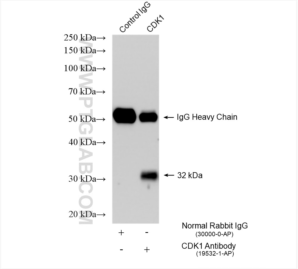 Immunoprecipitation (IP) experiment of HEK-293 cells using CDK1-Specific Polyclonal antibody (19532-1-AP)